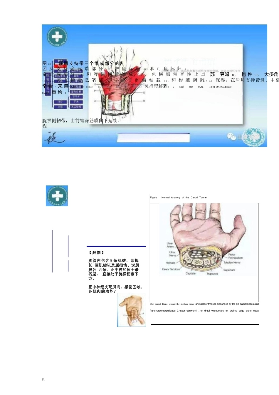腕管综合征的诊断与治 疗策略_第3页