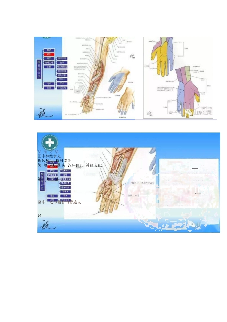 腕管综合征的诊断与治 疗策略_第4页