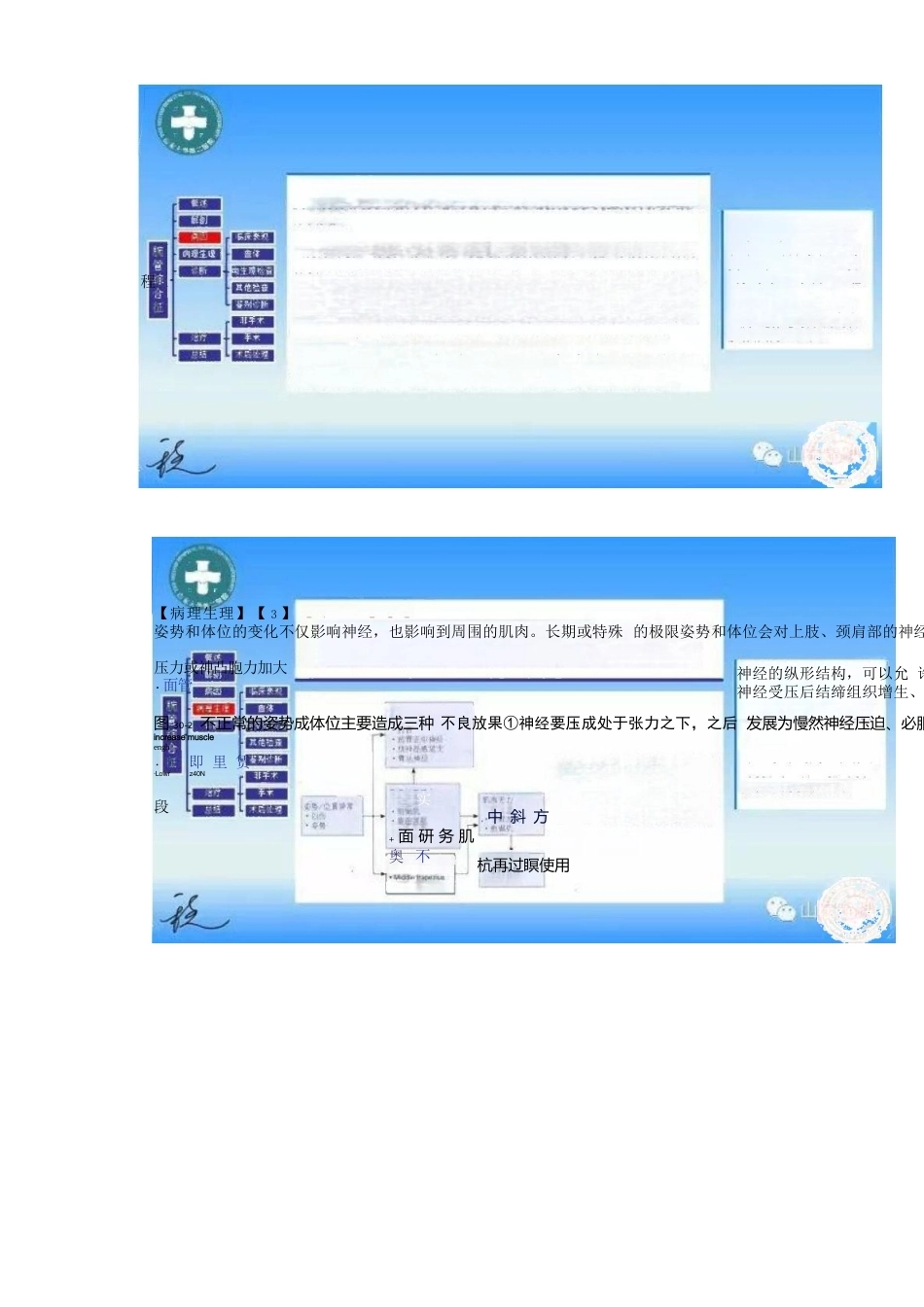 腕管综合征的诊断与治 疗策略_第7页