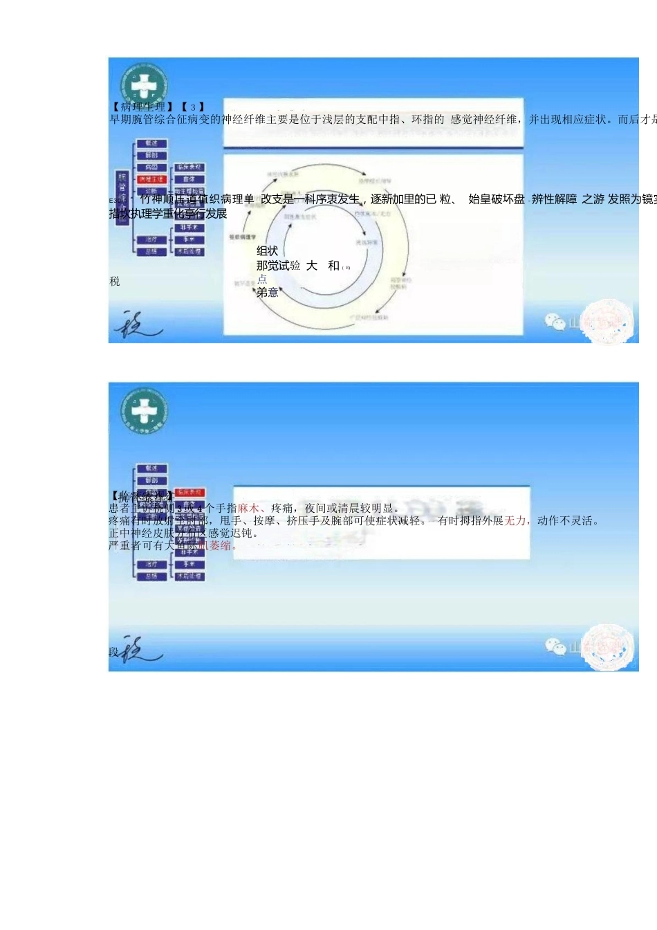腕管综合征的诊断与治 疗策略_第8页