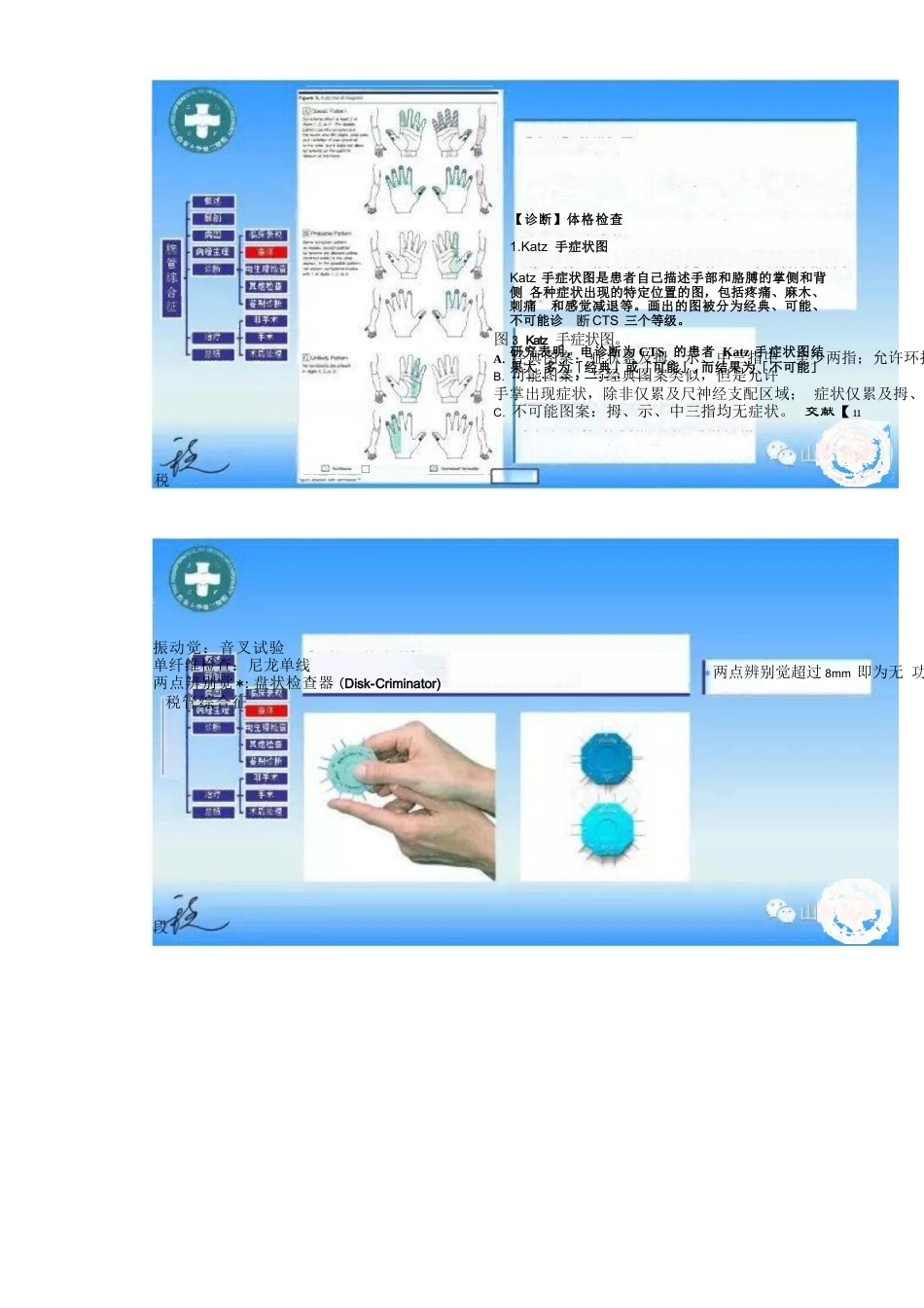腕管综合征的诊断与治 疗策略_第9页