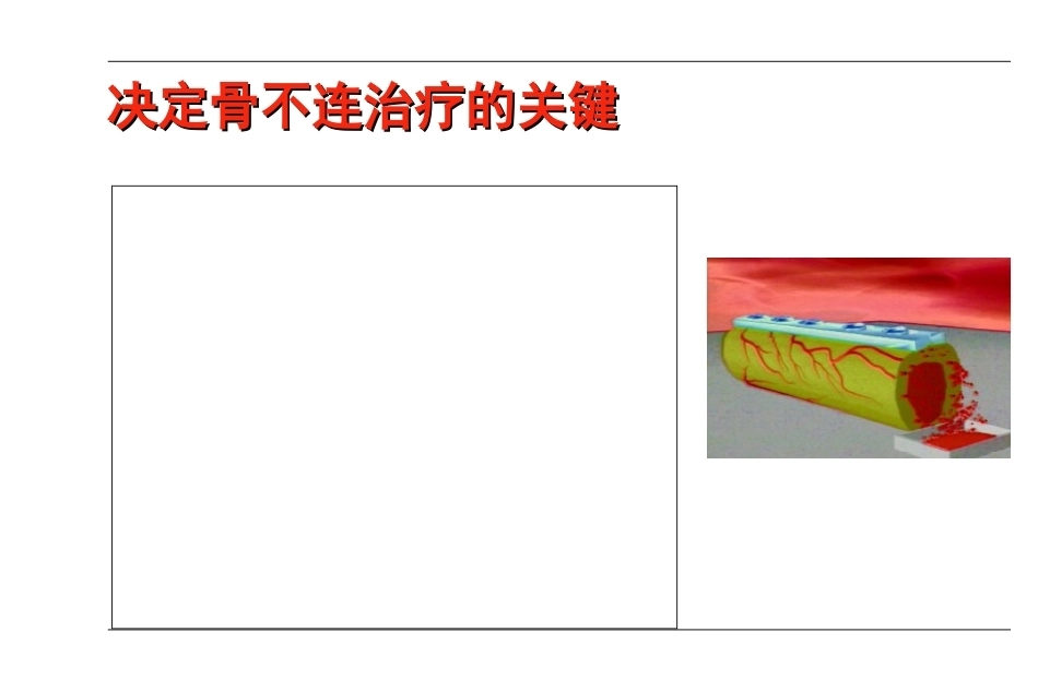 AO-骨不连和骨延迟愈合_第13页