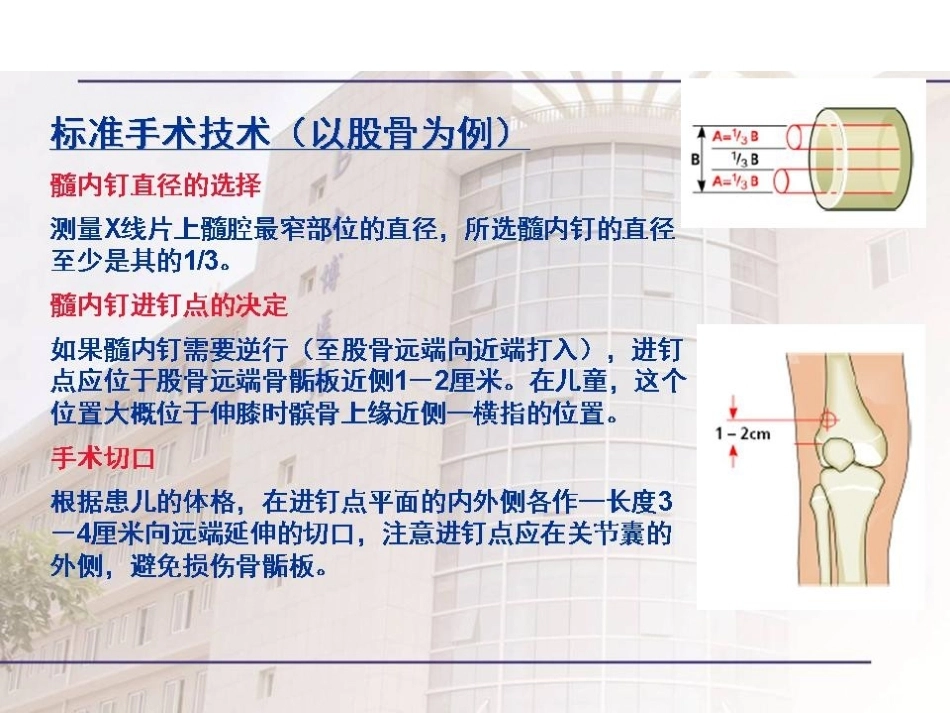 弹性髓内 钉治疗儿童骨折操作技巧_第14页