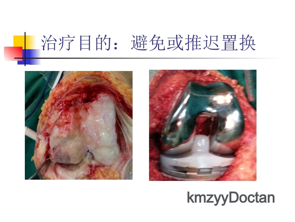 软骨修复_第10页