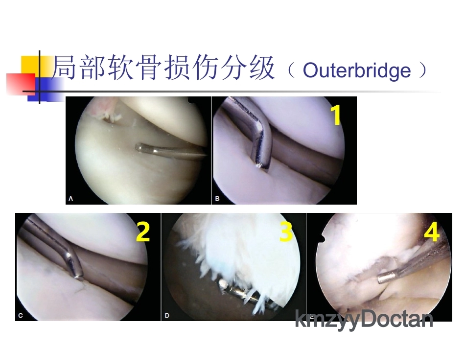 软骨修复_第11页