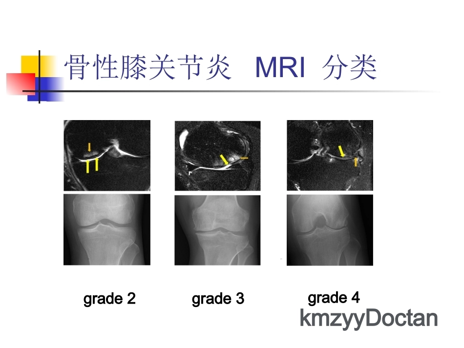 软骨修复_第15页