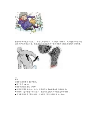 股骨颈骨折的分型与治疗策略