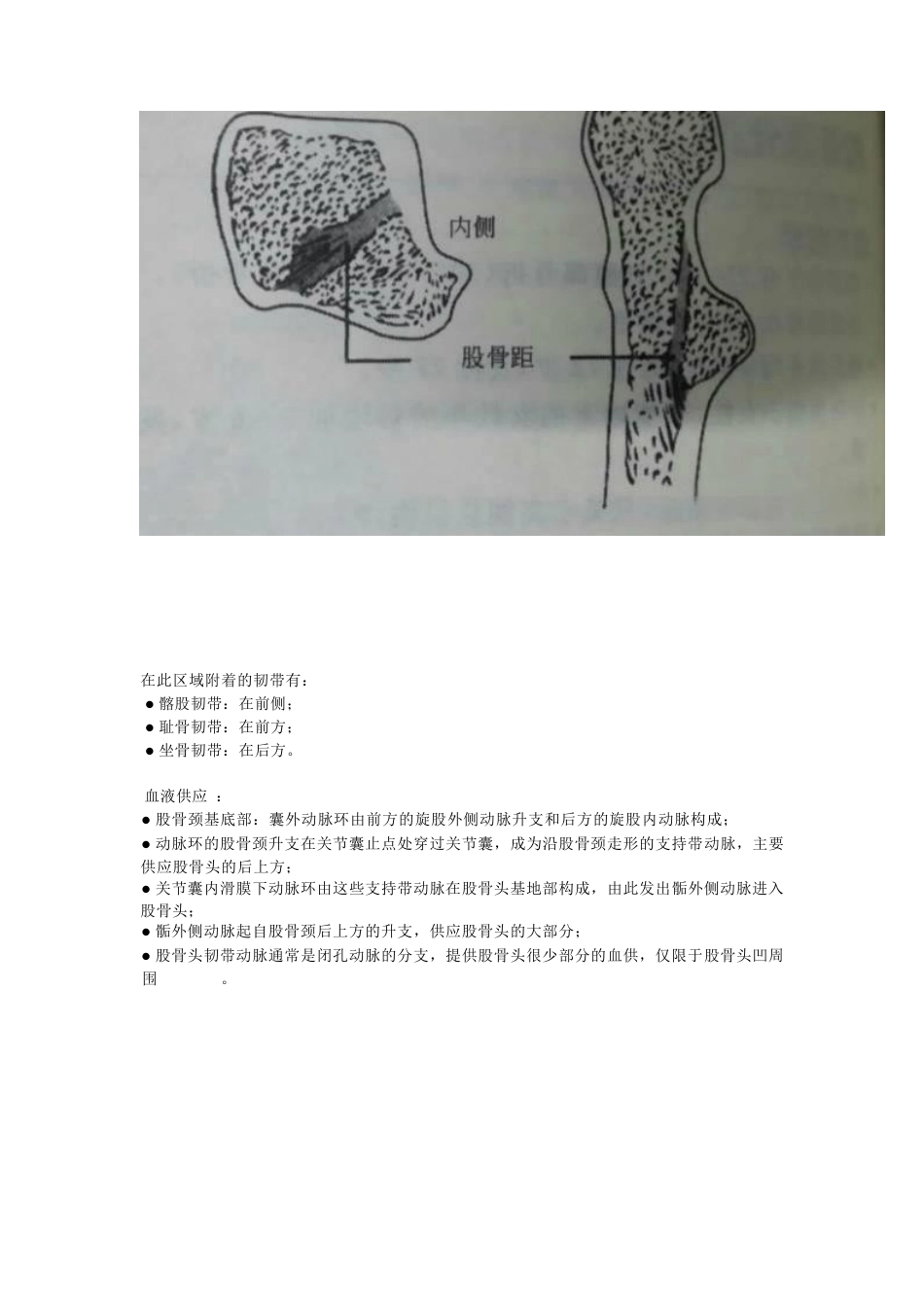 股骨颈骨折的分型与治疗策略_第2页