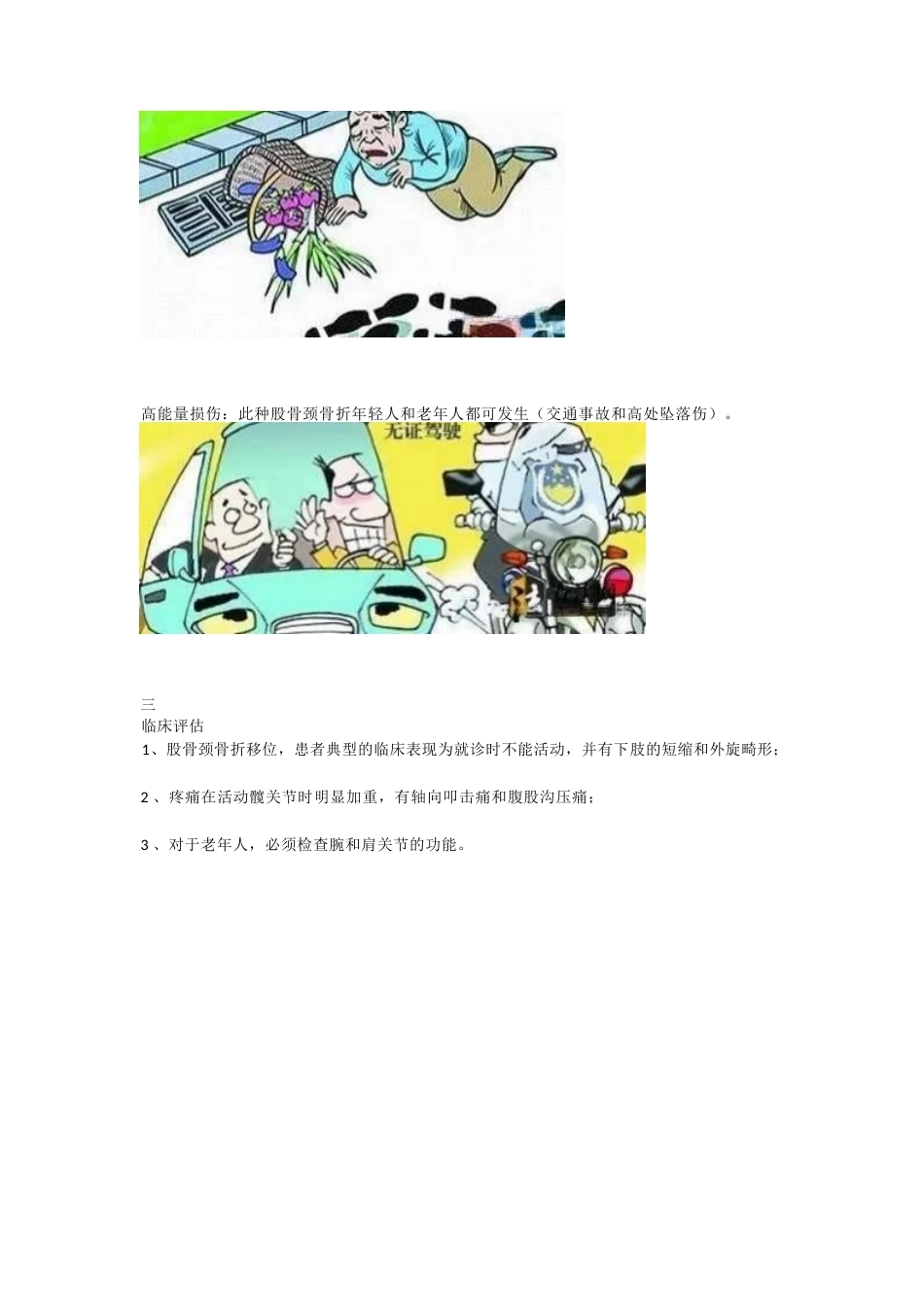 股骨颈骨折的分型与治疗策略_第4页