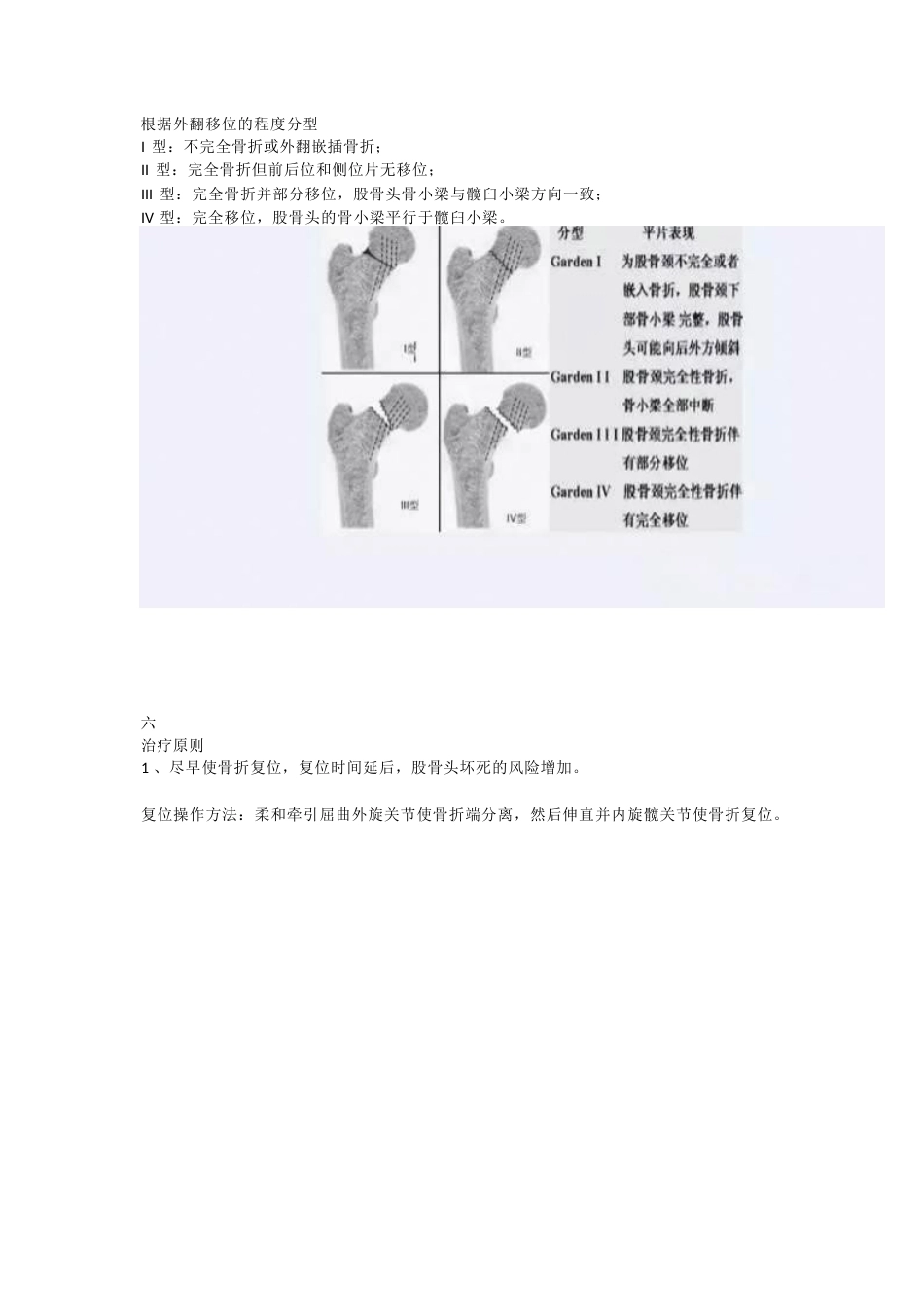 股骨颈骨折的分型与治疗策略_第7页