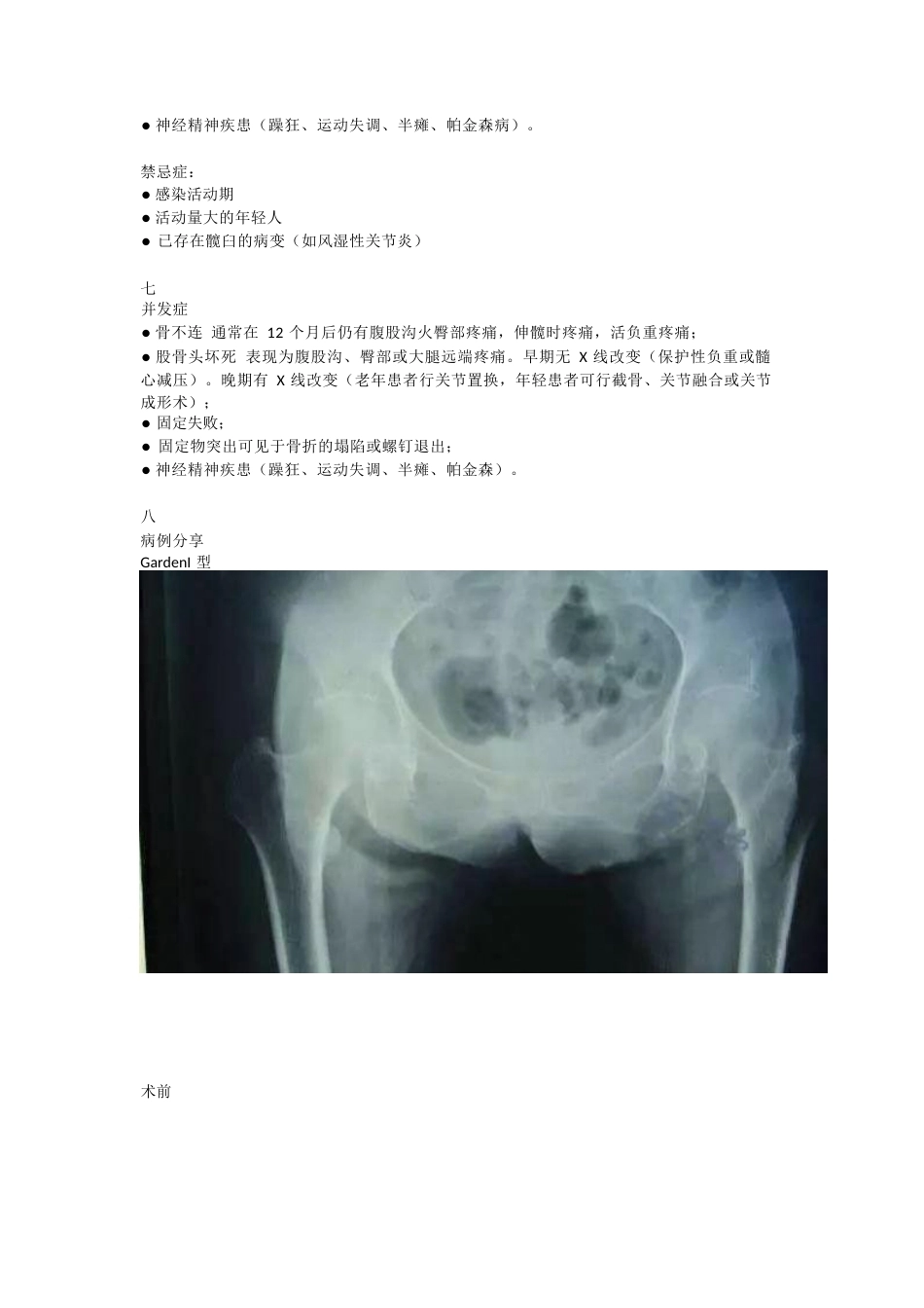 股骨颈骨折的分型与治疗策略_第9页