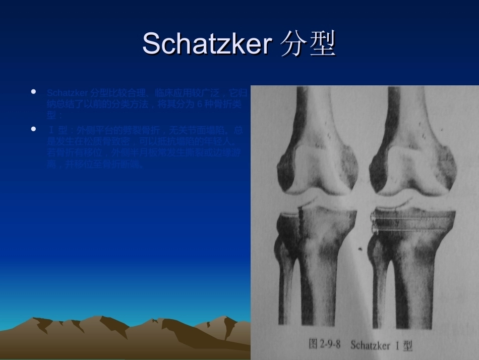 胫骨平台骨折的诊断及治疗_第7页