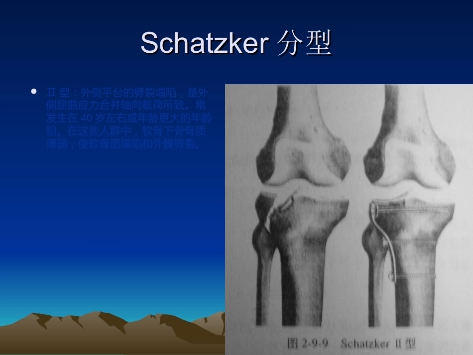 胫骨平台骨折的诊断及治疗_第8页