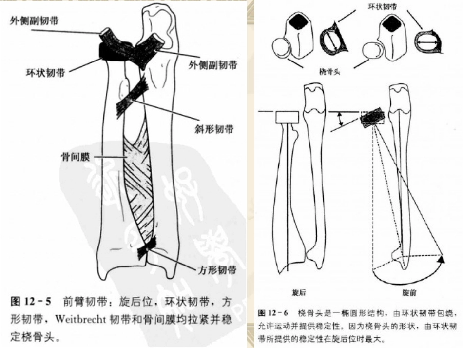 孟氏骨折_第6页