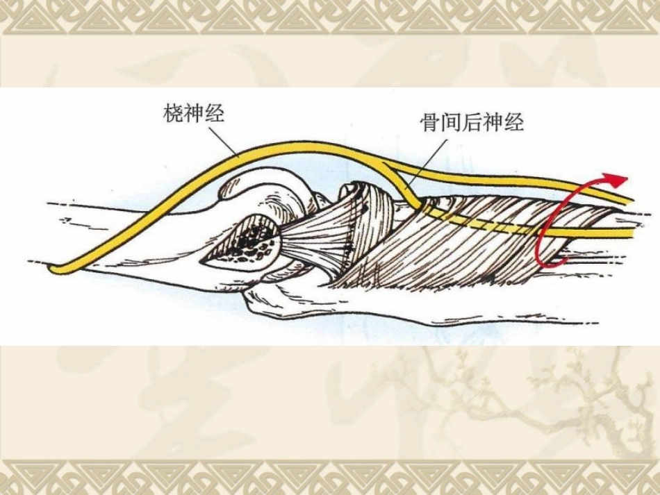 孟氏骨折_第7页