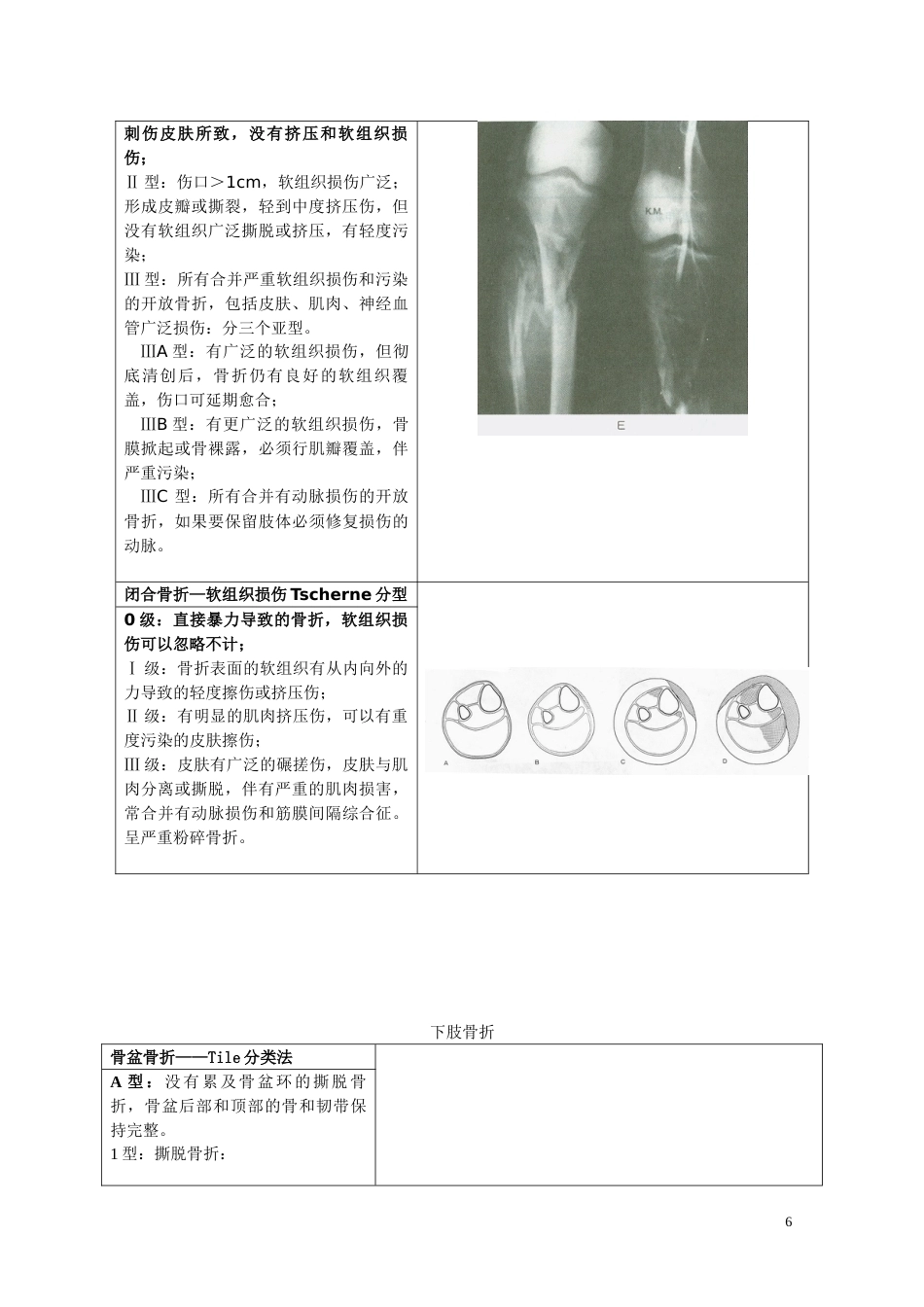 骨折分型参照表_第6页