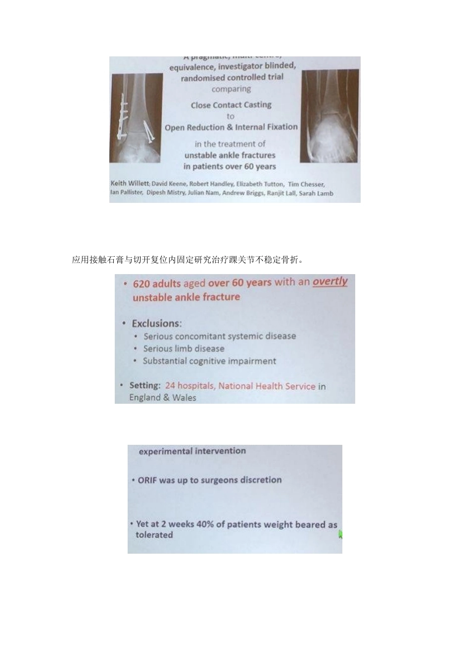 踝关节骨折后到底什么时候负重_第11页