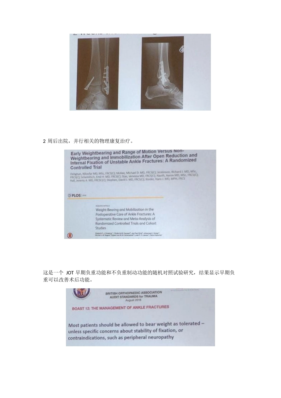 踝关节骨折后到底什么时候负重_第3页