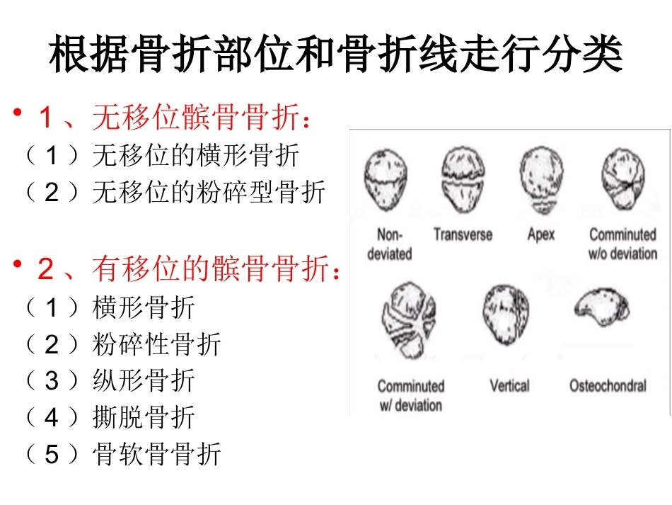 髌骨骨折_第6页