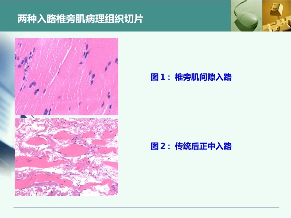 胸腰椎椎弓根置钉技术_第11页