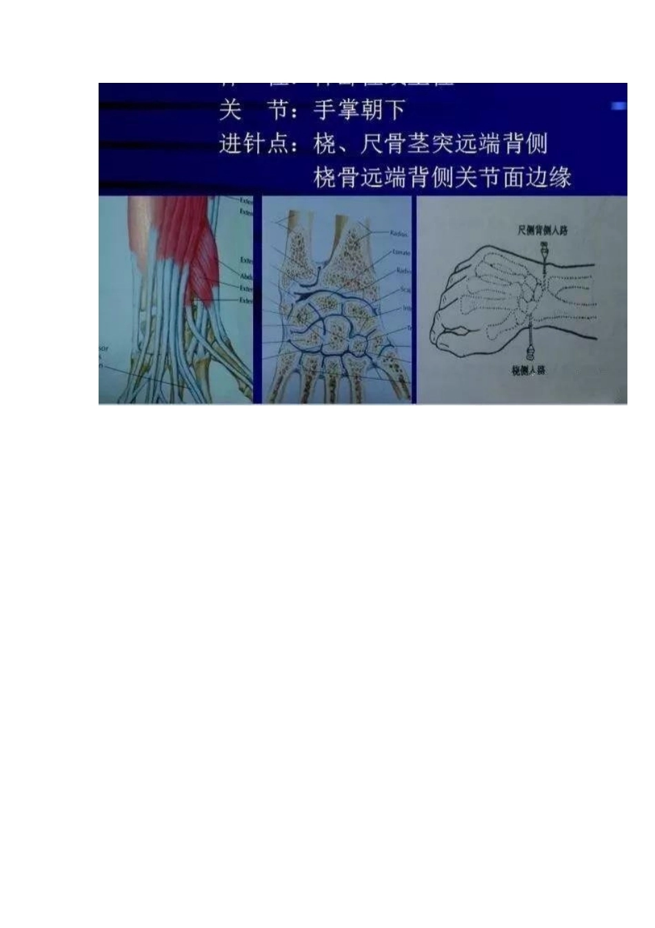 各关节腔穿刺 方法技巧大全_第9页