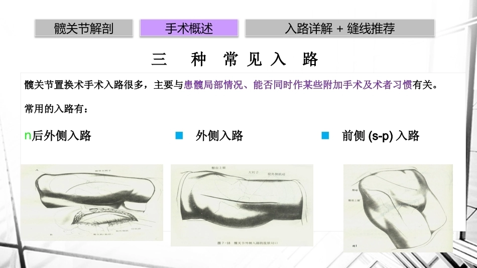 人工全髋关节置换术后 脱位_第10页