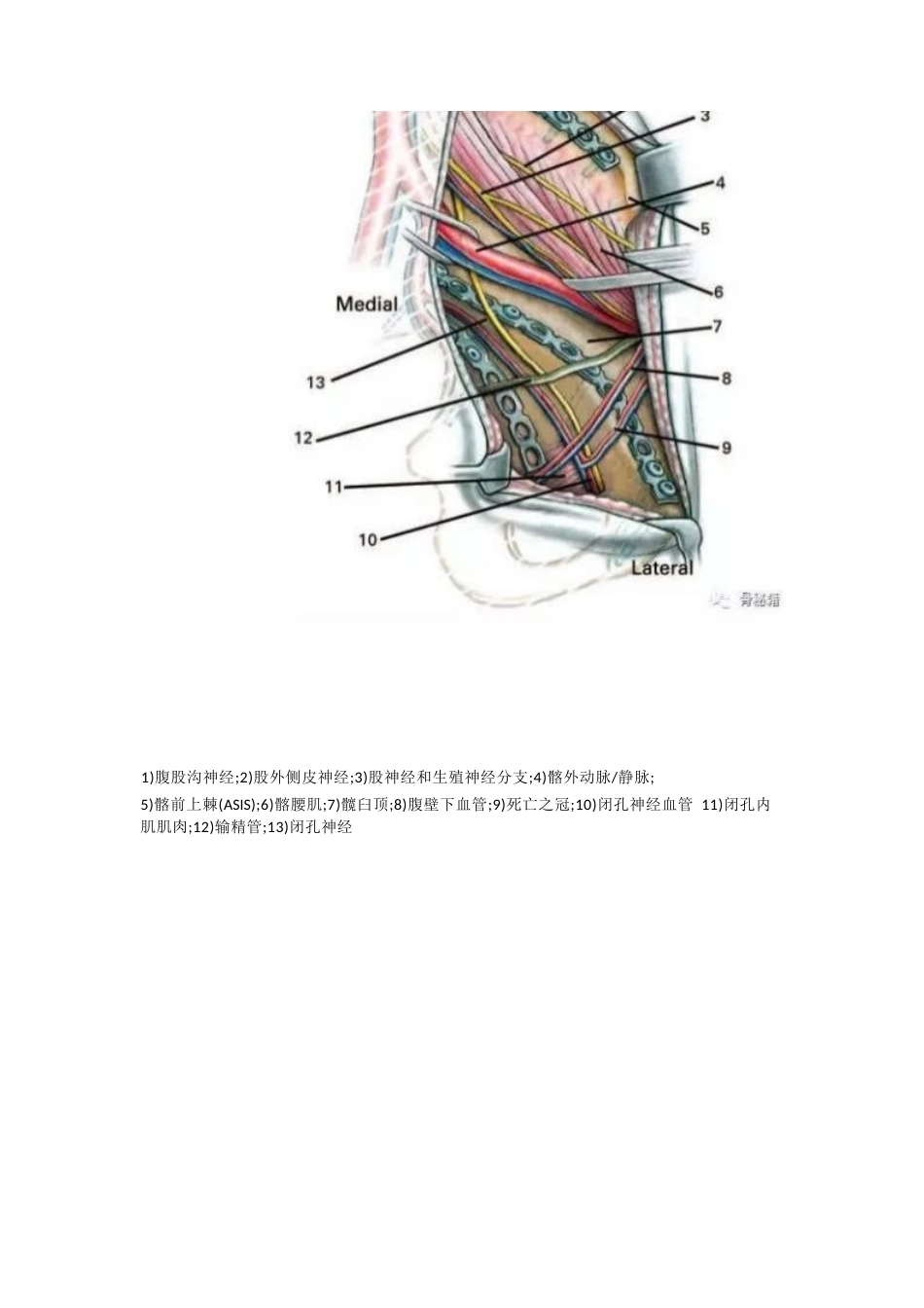 髋臼的必备入路腹直肌旁入路_第5页