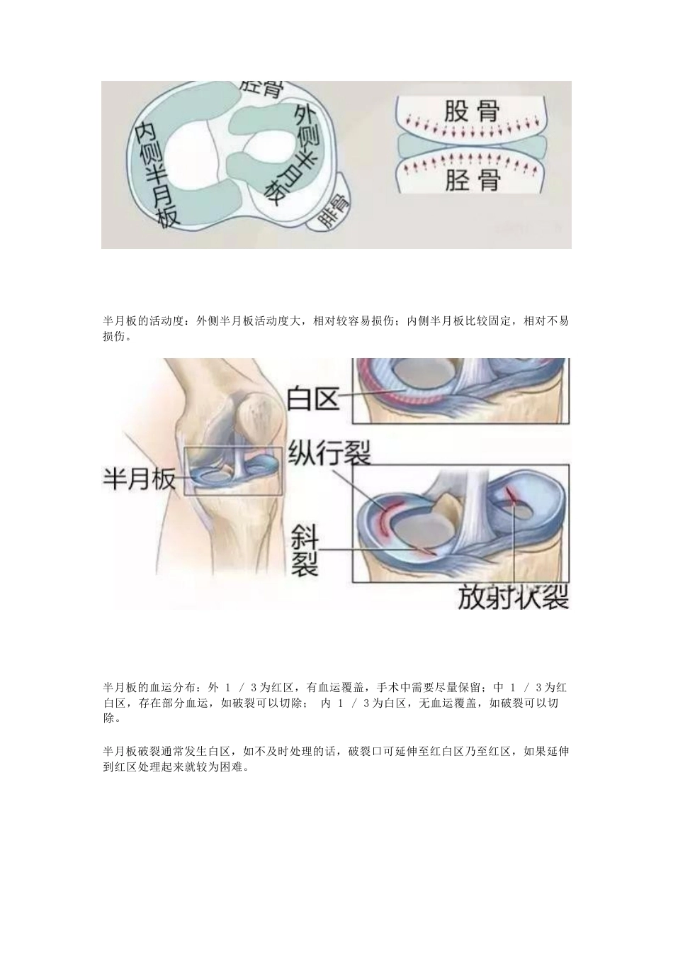 半月板的损伤 及治疗_第2页