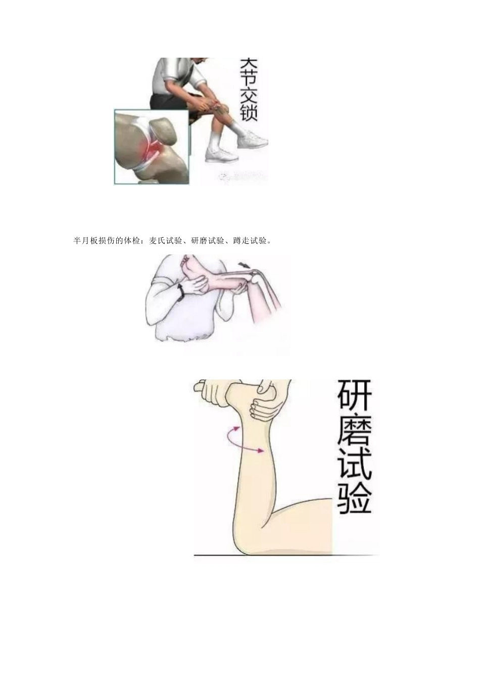 半月板的损伤 及治疗_第5页