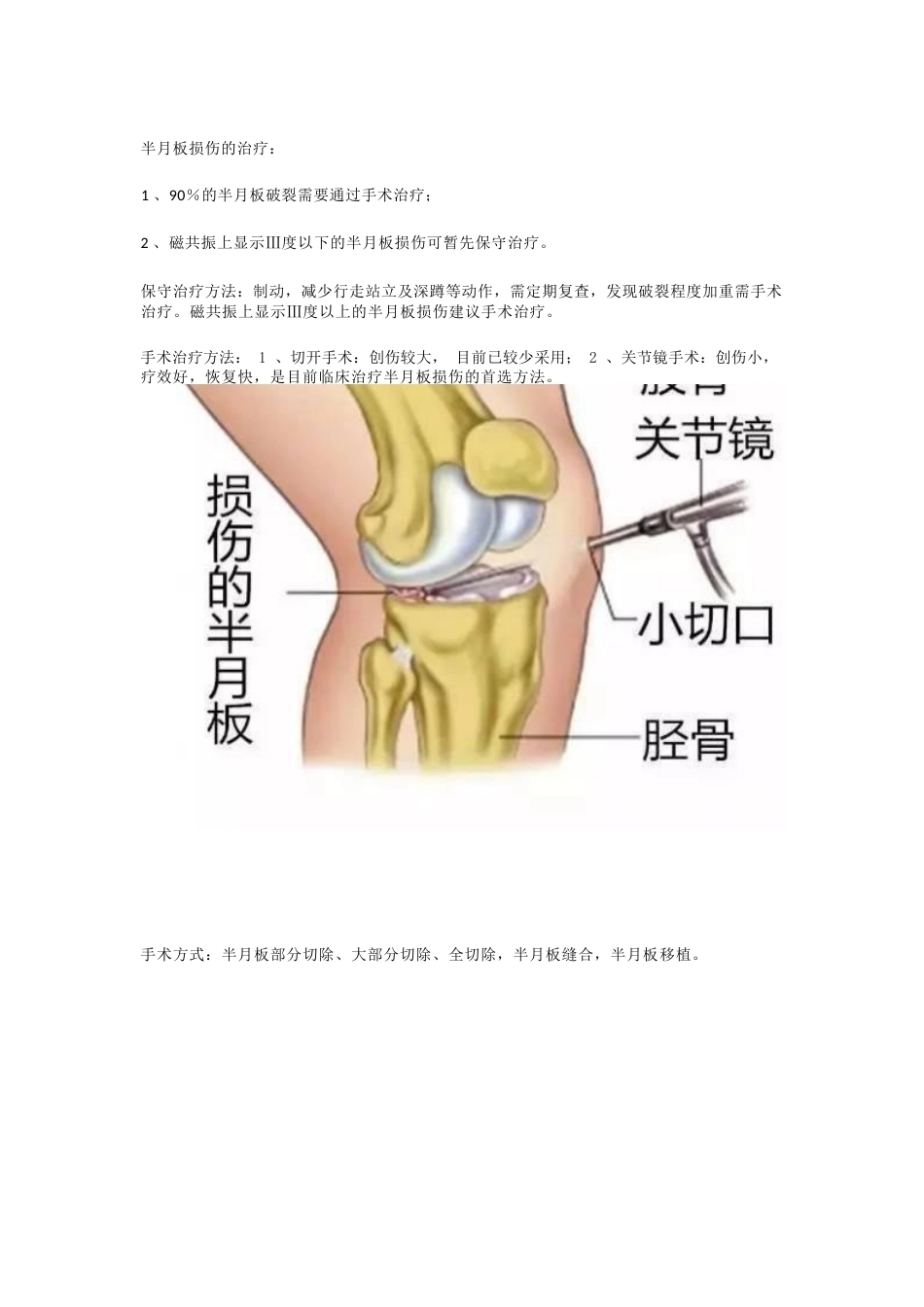 半月板的损伤 及治疗_第7页