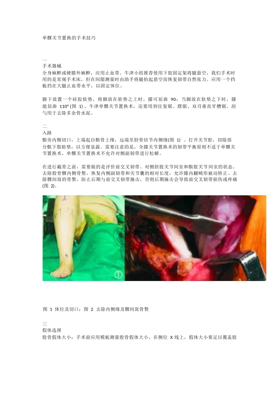 单髁关节置换 的手术技巧_第1页
