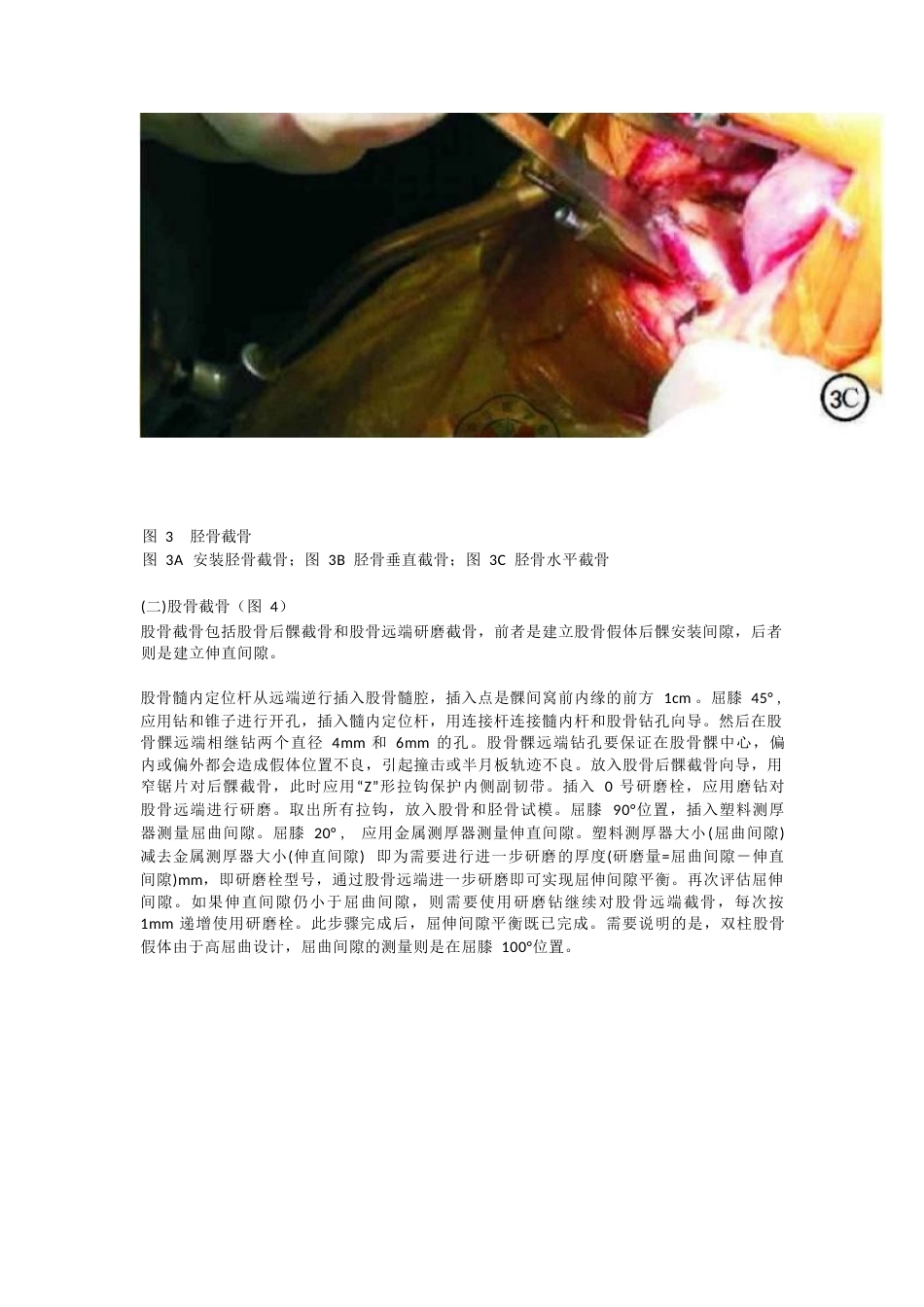 单髁关节置换 的手术技巧_第4页