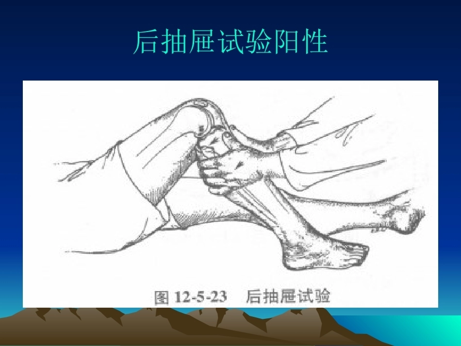 膝关节后交叉韧带 损伤_第13页