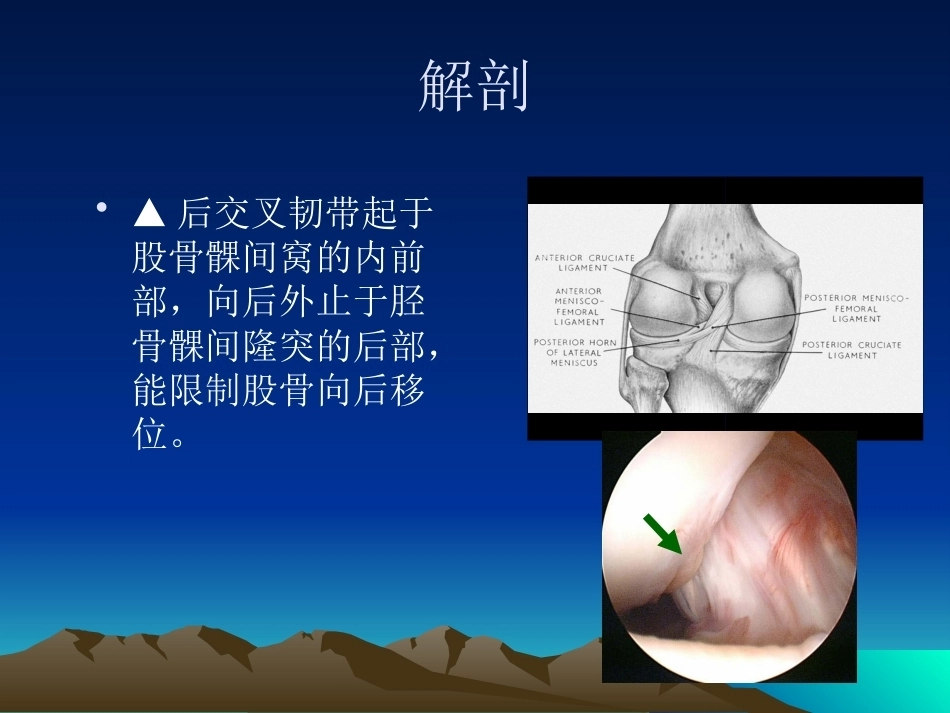 膝关节后交叉韧带 损伤_第4页