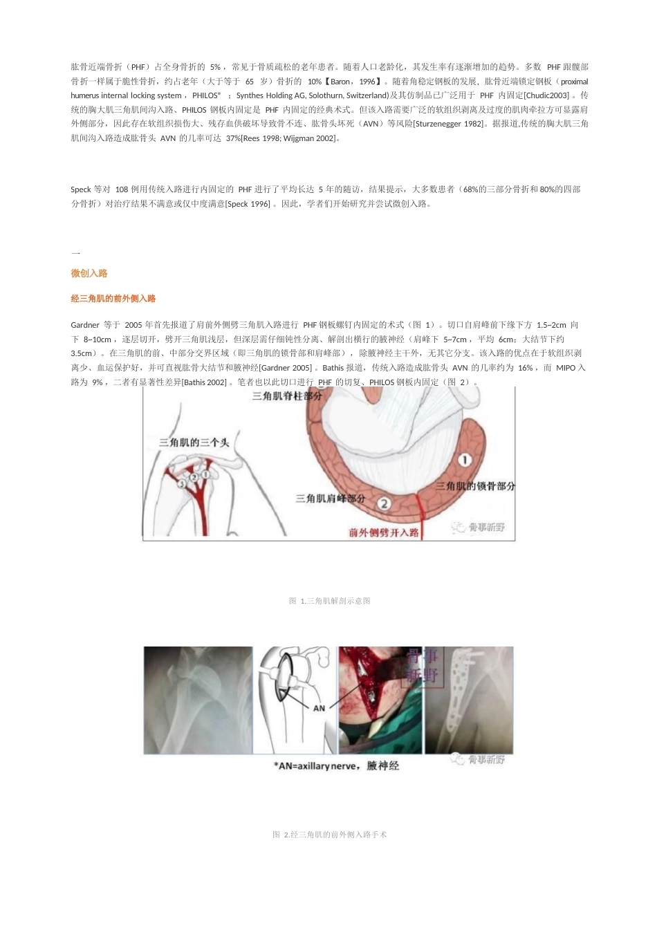 肱骨近端骨折的微创入 路ORIF手术技巧_第1页
