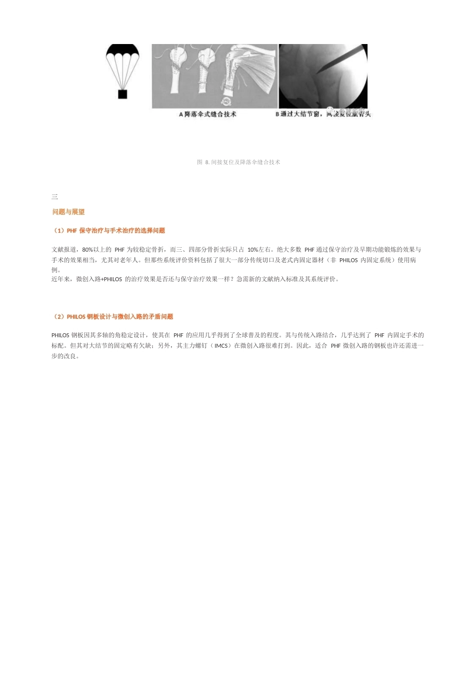 肱骨近端骨折的微创入 路ORIF手术技巧_第6页