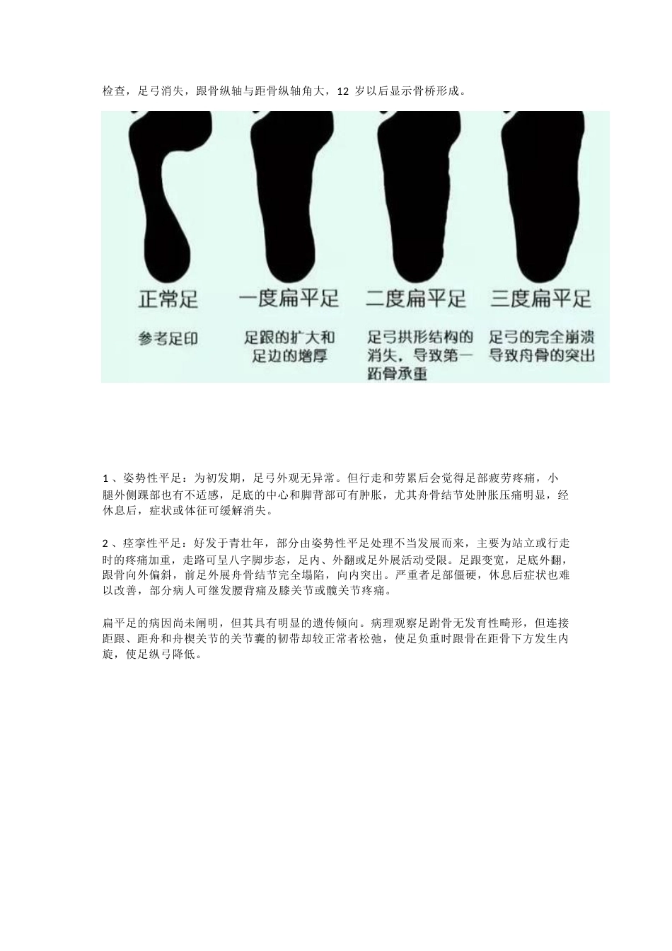 扁平足的 临床诊治技巧_第2页