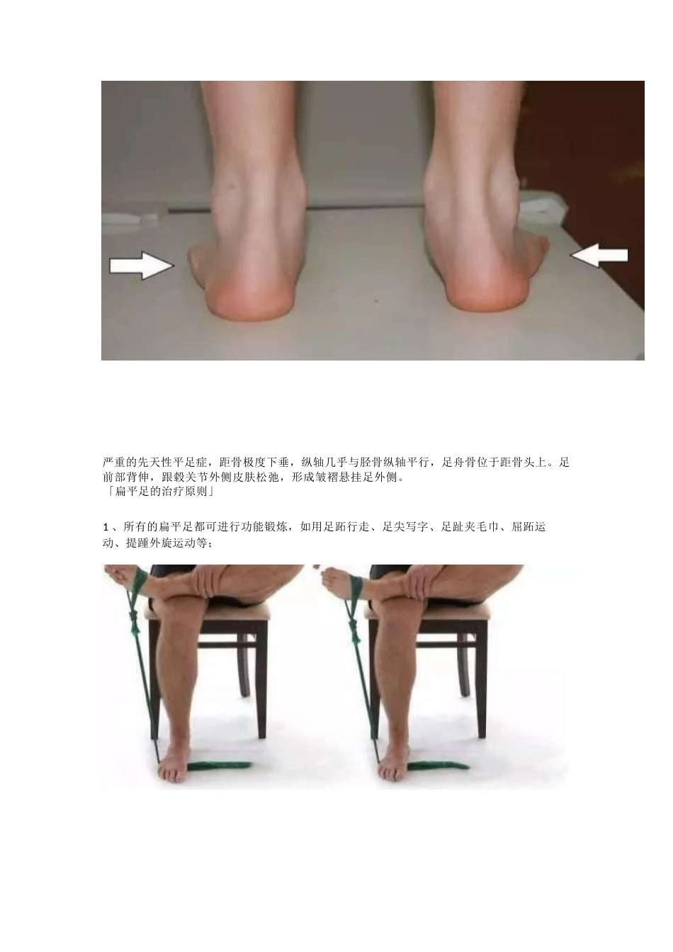 扁平足的 临床诊治技巧_第4页