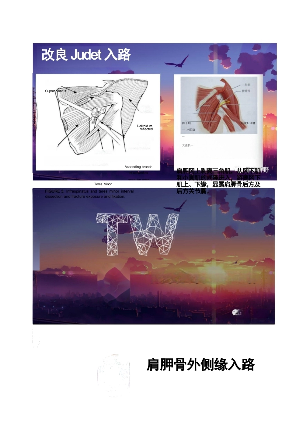 肩胛骨骨折的手术 入路解析_第4页