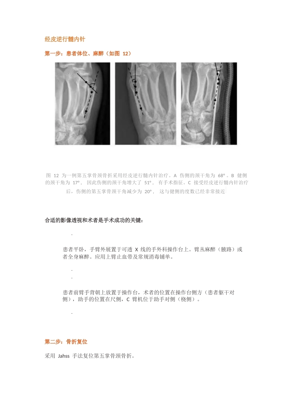 髓内针治疗移位性掌骨颈 骨折技术_第12页