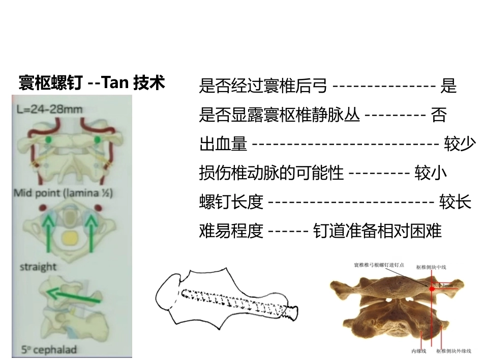 上颈椎后路内固定技术复件_第10页
