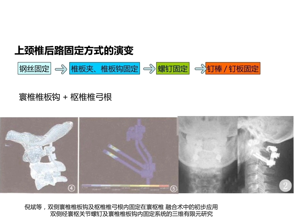 上颈椎后路内固定技术复件_第7页