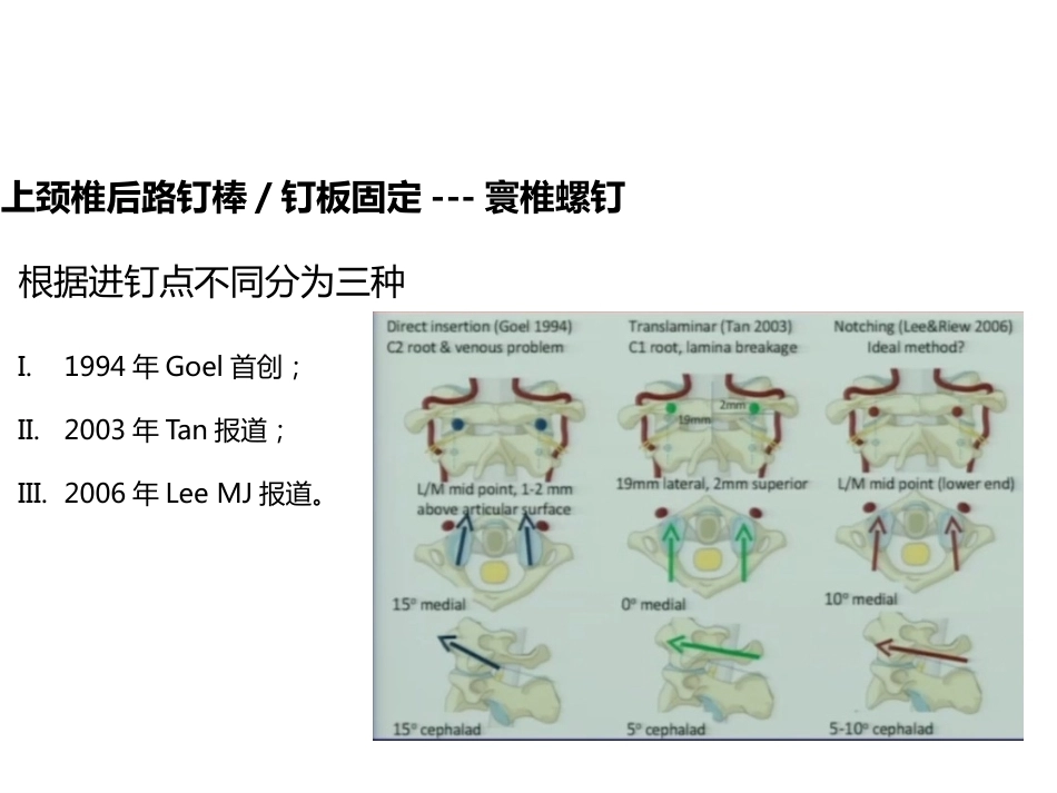 上颈椎后路内固定技术复件_第8页