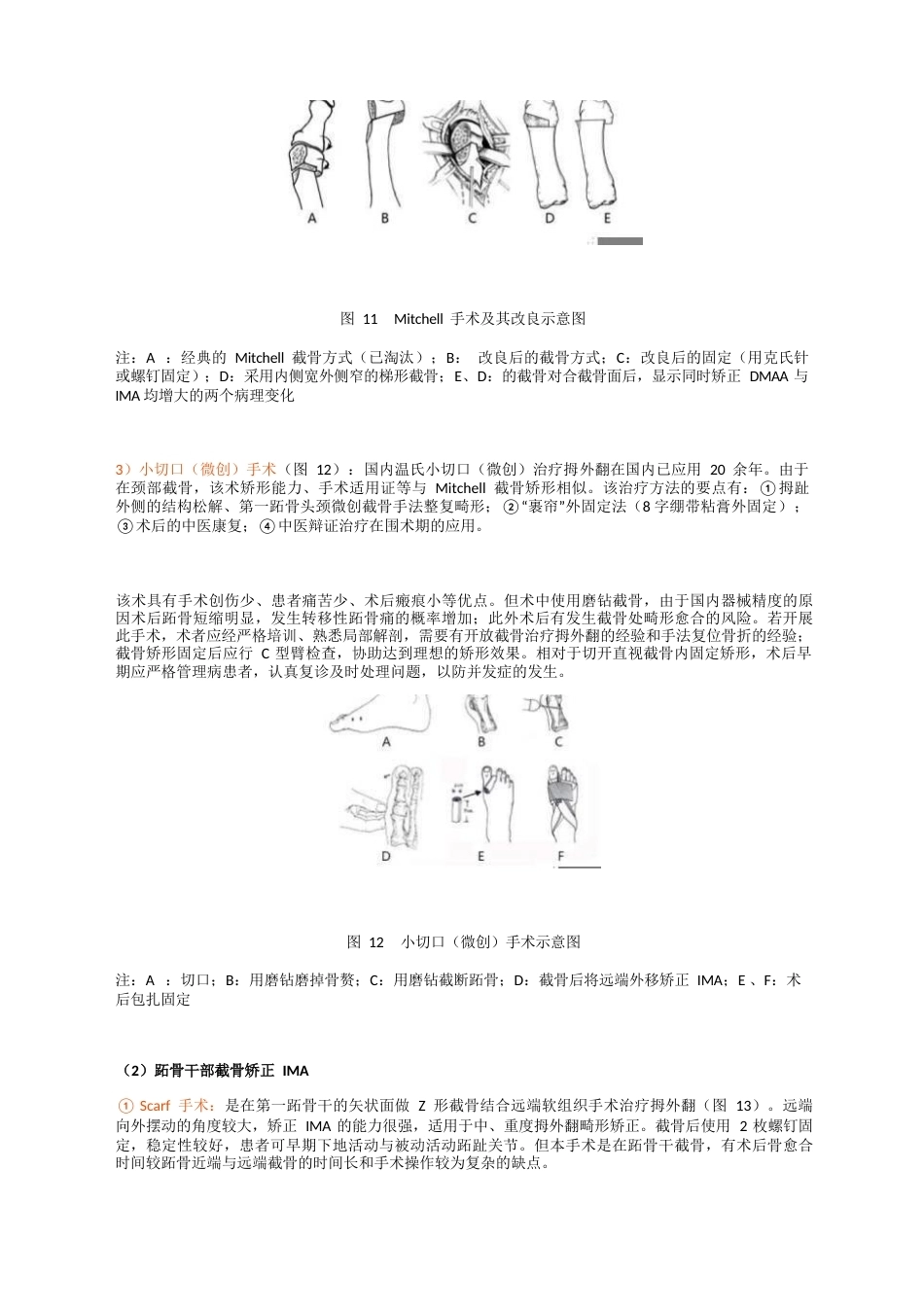 拇外翻 诊疗专家共识_第12页