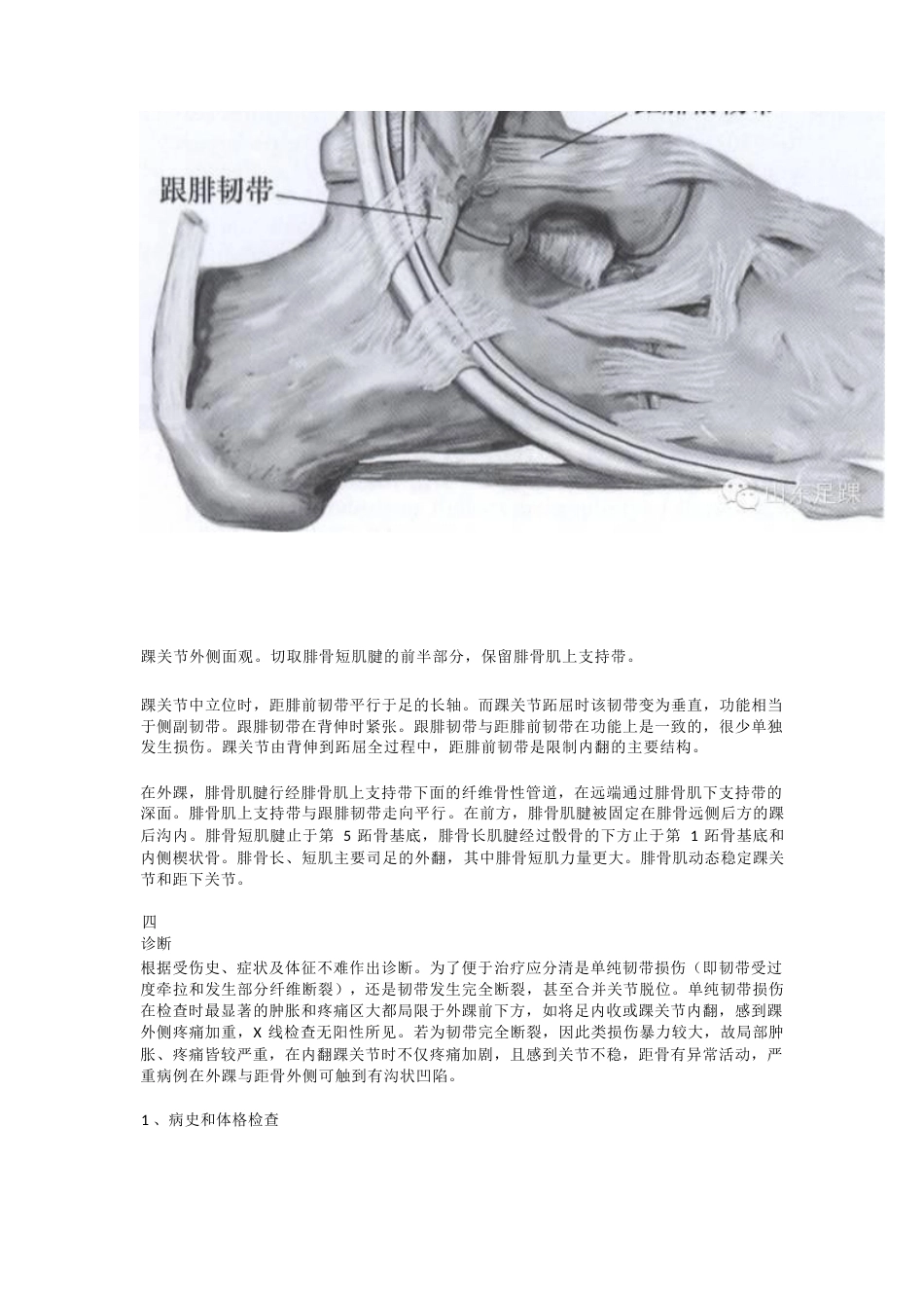急性踝关节扭伤与慢性踝关节 不稳的治疗_第3页