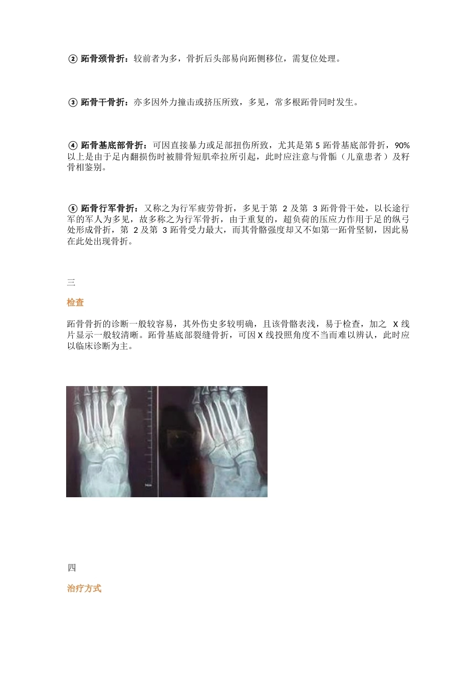 跖骨骨折的分型及临床诊治_第2页