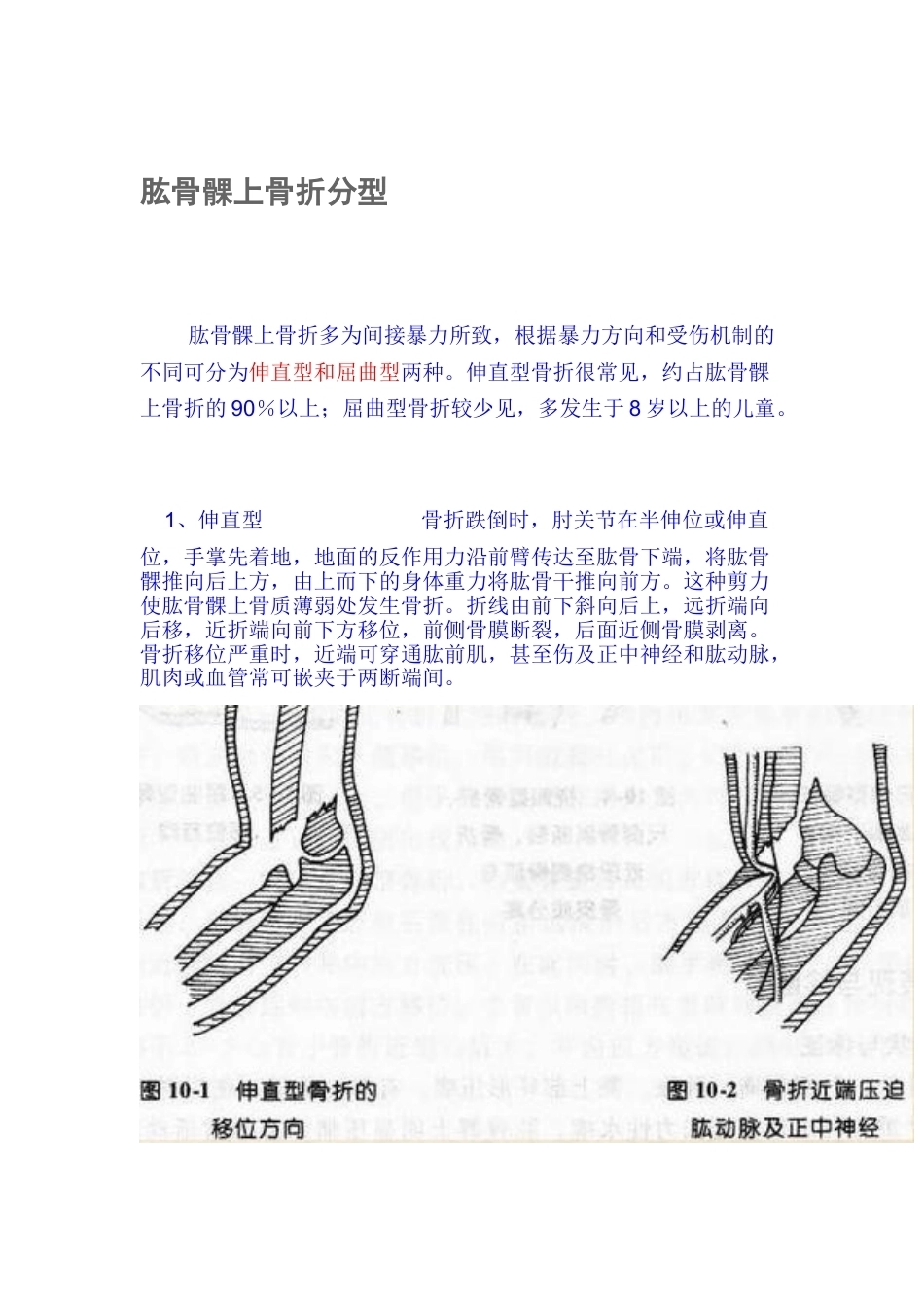 肱骨髁上骨折分型_第1页