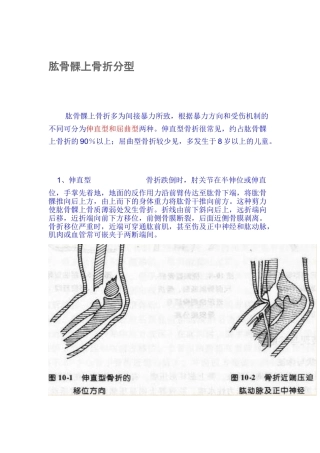 肱骨髁上骨折分型