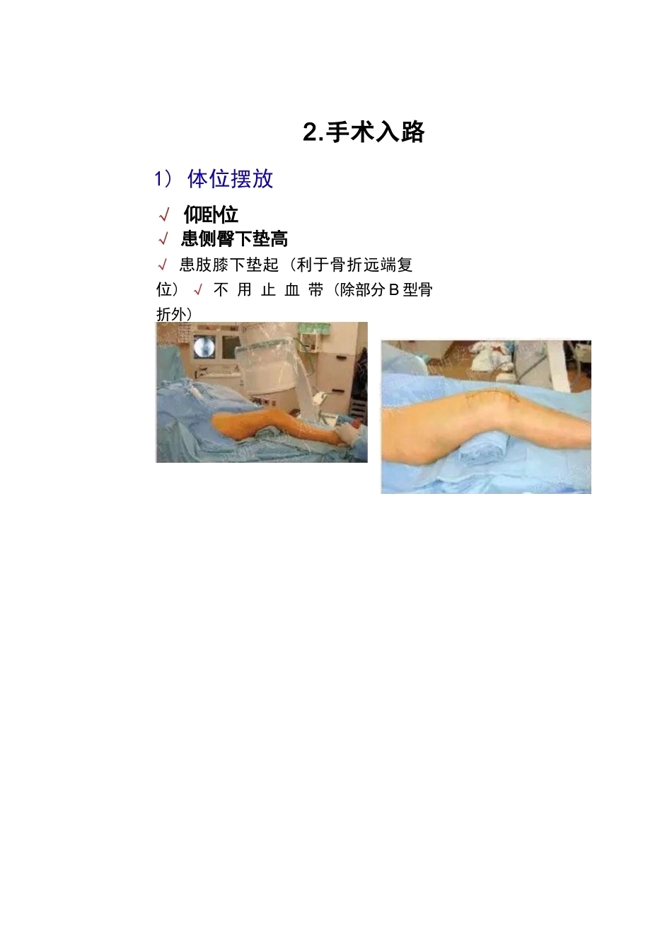 股骨远端骨折的手 术治疗技巧_第10页