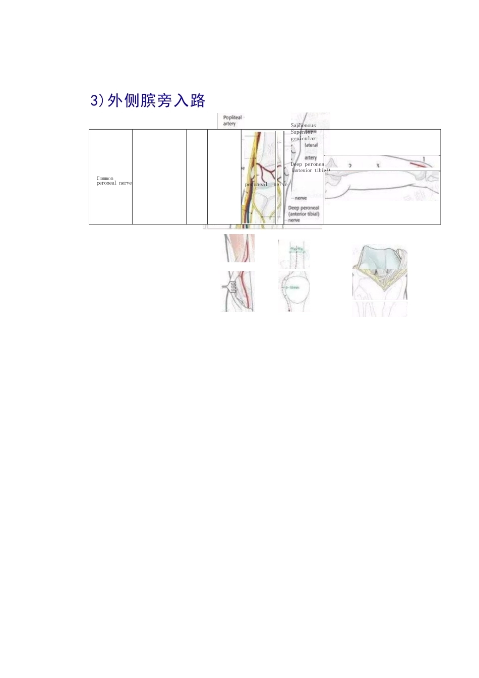 股骨远端骨折的手 术治疗技巧_第12页